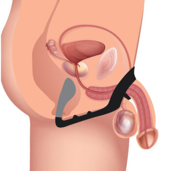 Excursion Silicone Triple Stim Anal Plug with Cock and Ball Ring - Image 4